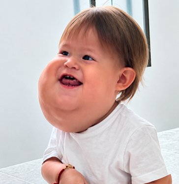 Valentino, el bebé cucuteño que luchó por atención médica