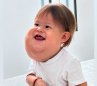 Valentino, el bebé cucuteño que luchó por atención médica