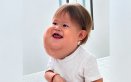 Valentino, el bebé cucuteño que luchó por atención médica