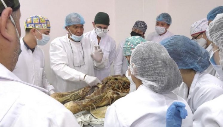 Los hallazgos están relacionados con variaciones anatómicas./Foto: cortesía Unipamplona