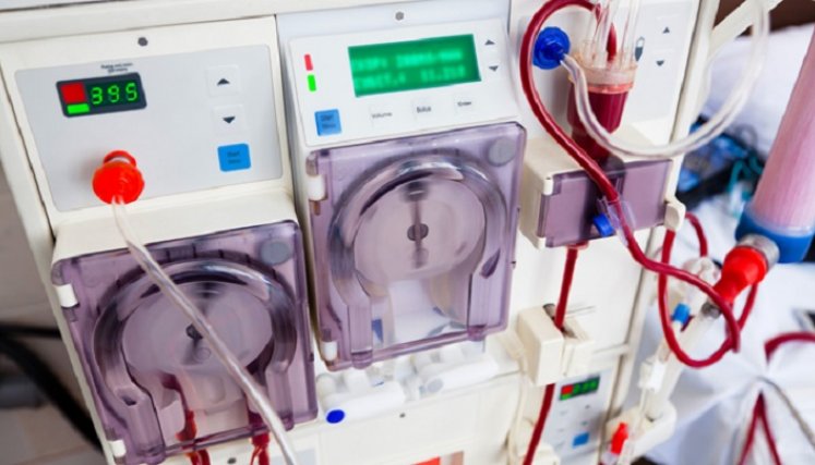 La situación es crítica para pacientes renales que necesitan diálisis. / Cortesía/ La Opinión 