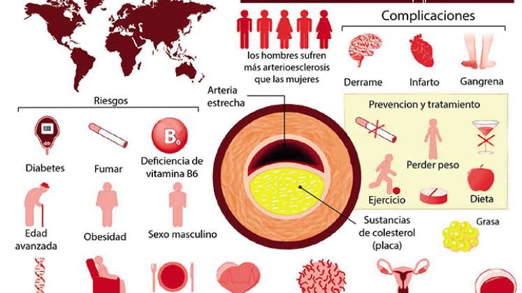 Mapa de arteriosclerosis