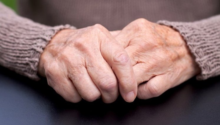Parkinson.