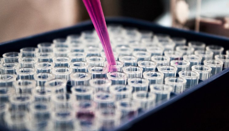 Una de las ventajas fundamentales de la implementación de terapias innovadoras y avanzadas se refleja en la reducción de los costos sociales que generan esta clase de enfermedades multisistémicas y de manejo complejo. / Foto: Cortesía
