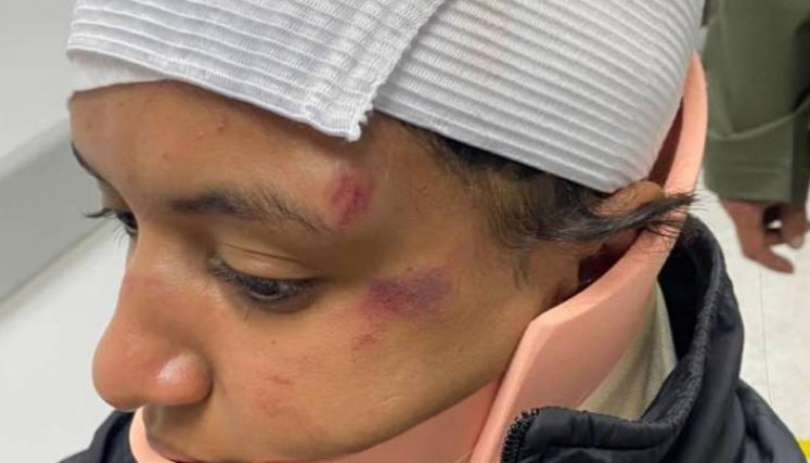 Mujer denuncia fuerte golpiza en un gimnasio de Bogotá tras discusión por una máquina