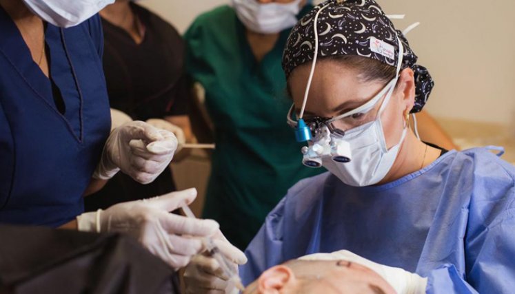 En Colombia, 3 de cada 7 hombres se realiza el implante de cabello.