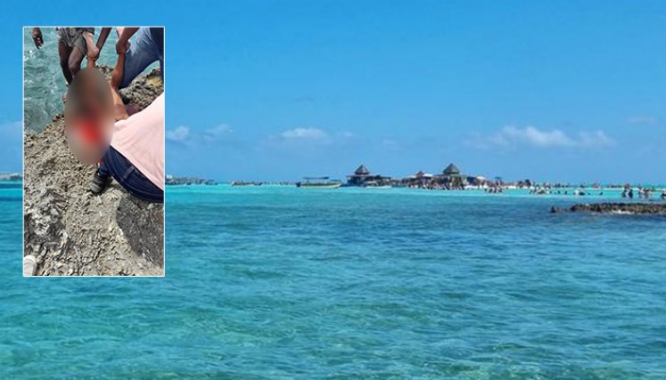Ataque de tiburón en San Andrés.
