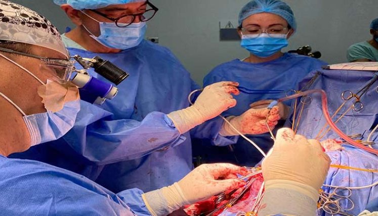 En el departamento es la primera vez que se practica una cirugía de epilepsia./Foto cortesía