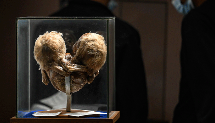 Los tesoros macabros de un Museo del Ser Humano en Colombia