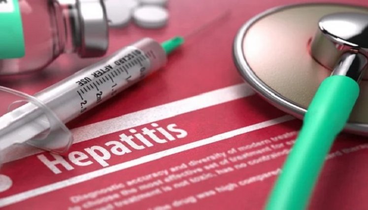 Hepatitis. / Foto: Cortesía