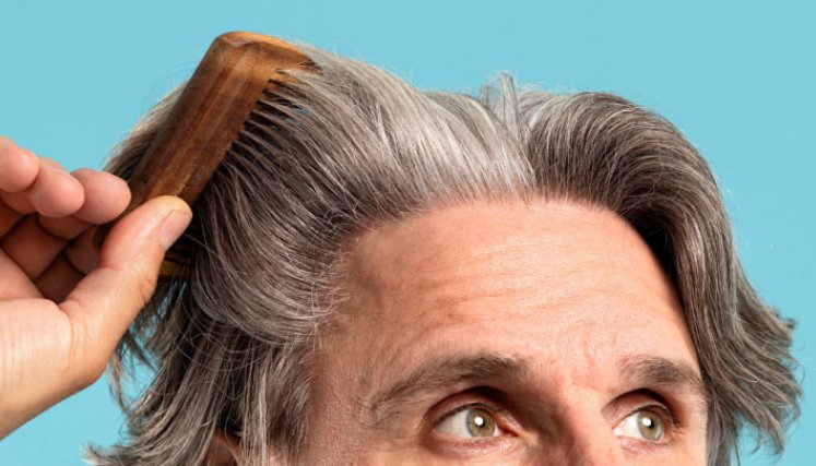 Canas en adultos.