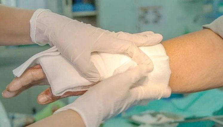 En Norte de Santander, para el periodo 2022-2023, 72 personas resultaron quemadas con pólvora, resaltando que los primeros lesionados se reportaron el 8 de diciembre de 2022./ Foto Cortesía / La Opinión 