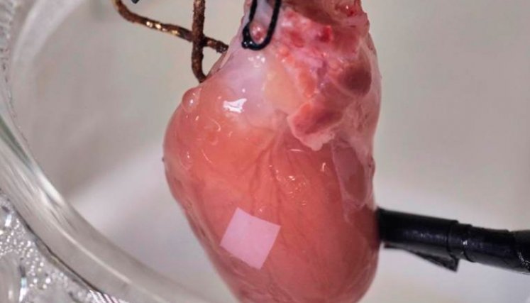 corazon