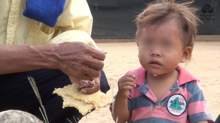 La desnutrición en Norte de Santander ha bajado, pero persisten los riesgos.