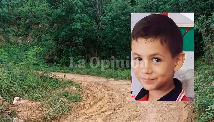 NIÑO-atacado-ABEJAS-cucuta
