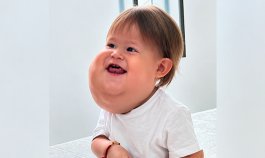 Valentino, el bebé cucuteño que luchó por atención médica