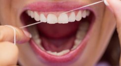 Dientes