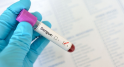 Dengue en Colombia.
