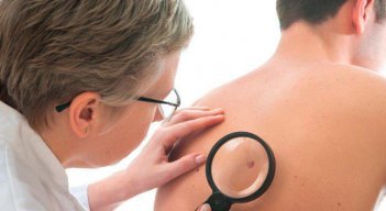 sarcoma