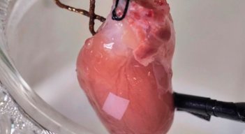 corazon
